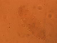 Media resource of Diphascon chilenense