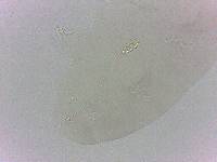 Diphascon chilenense image