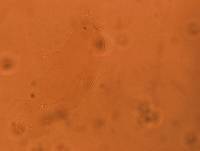 Diphascon chilenense image