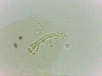 Doryphoribius evelinae image