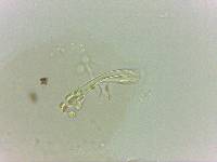 Doryphoribius evelinae image