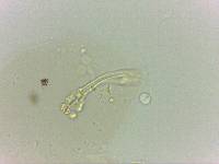Doryphoribius evelinae image
