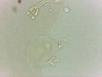 Doryphoribius evelinae image