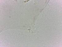 Doryphoribius evelinae image