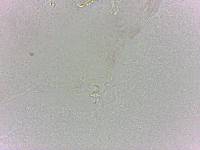 Doryphoribius evelinae image