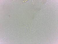 Doryphoribius evelinae image
