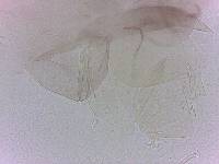 Doryphoribius evelinae image