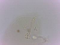 Doryphoribius evelinae image