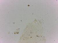 Doryphoribius flavus image
