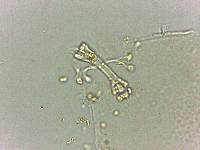 Doryphoribius flavus image