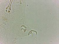 Doryphoribius flavus image