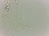 Doryphoribius flavus image