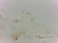 Doryphoribius flavus image