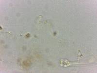Doryphoribius flavus image