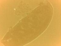 Doryphoribius zyxiglobus image