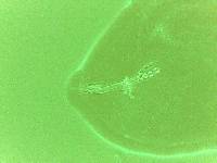 Doryphoribius zyxiglobus image
