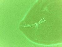 Doryphoribius zyxiglobus image