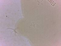 Doryphoribius zappalai image
