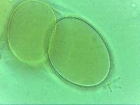 Doryphoribius zappalai image