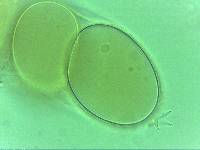 Doryphoribius zappalai image