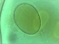 Doryphoribius zappalai image