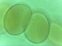 Doryphoribius zappalai image