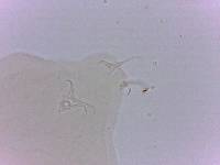 Doryphoribius zappalai image