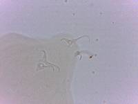 Doryphoribius zappalai image