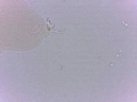 Doryphoribius zappalai image