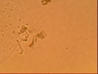 Echiniscoides sigismundi image