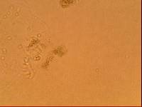 Echiniscoides sigismundi image
