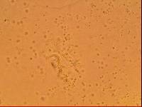 Echiniscoides sigismundi image