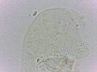 Echiniscoides sigismundi image
