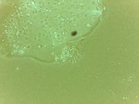 Echiniscoides sigismundi image