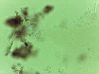 Echiniscoides sigismundi image