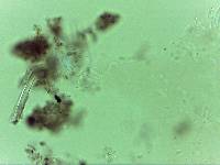 Echiniscoides sigismundi image