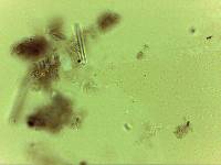 Echiniscoides sigismundi image