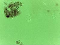 Echiniscoides sigismundi image