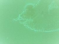 Echiniscoides sigismundi image