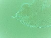 Echiniscoides sigismundi image