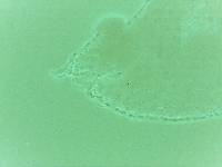 Echiniscoides sigismundi image