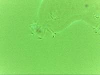 Echiniscoides sigismundi image