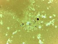 Echiniscoides sigismundi image