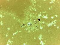 Echiniscoides sigismundi image