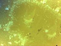 Echiniscoides sigismundi image