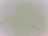 Echiniscoides sigismundi image
