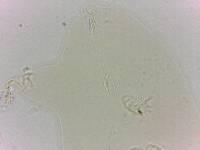 Echiniscoides sigismundi image