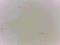 Echiniscoides sigismundi image