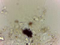 Echiniscoides sigismundi image
