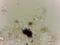 Echiniscoides sigismundi image